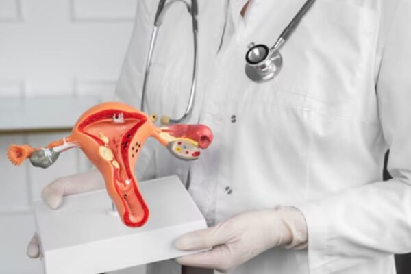 Cervical Cancer