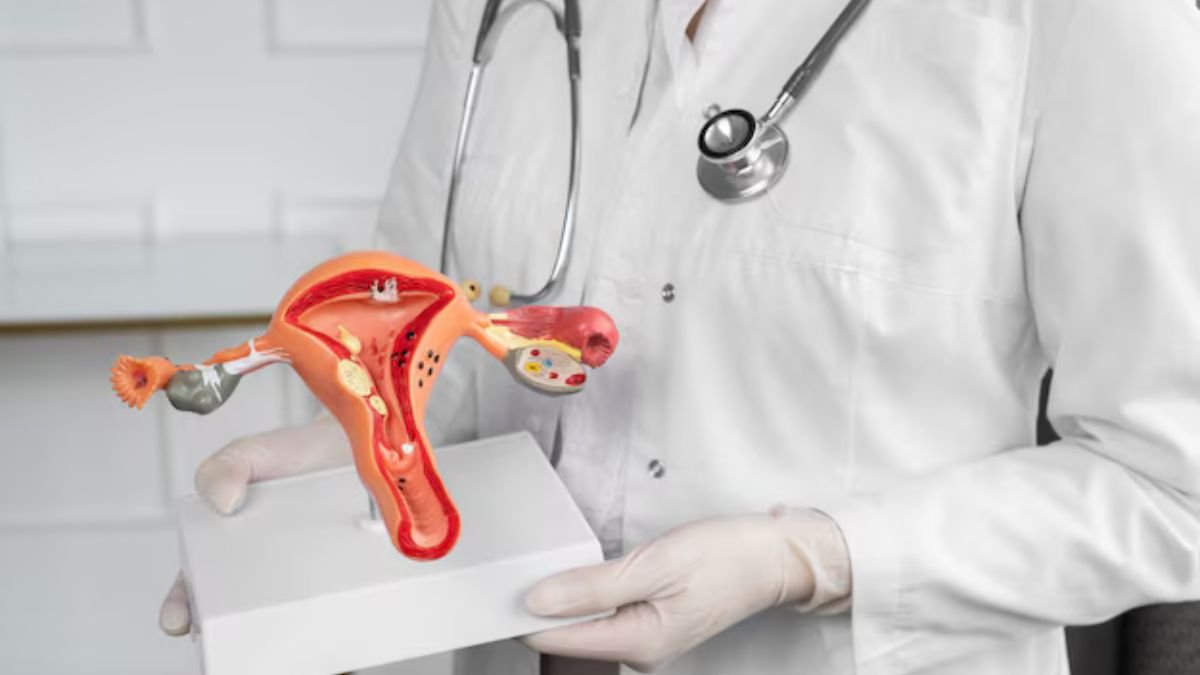 Cervical Cancer