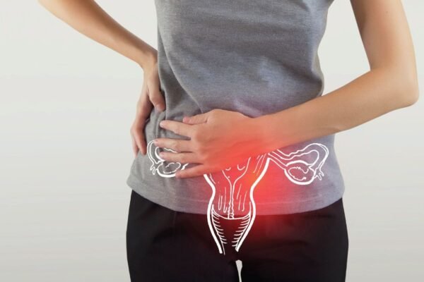 PCOD and PCOS