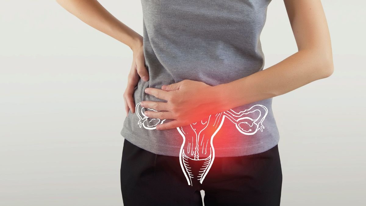 PCOD and PCOS