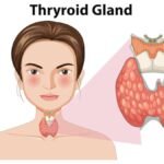 Thyroid