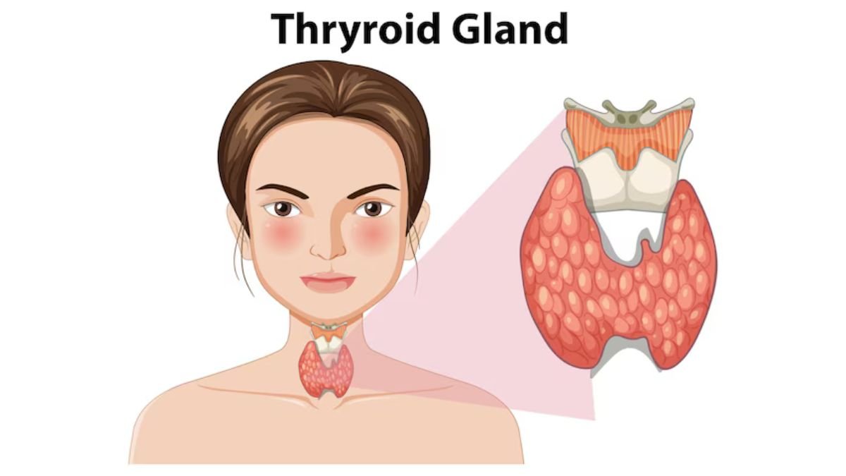 Thyroid